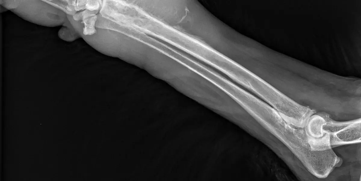 Bone Tumor in Dogs: What an Aggressive Lesion on a Leg X-Ray Means
