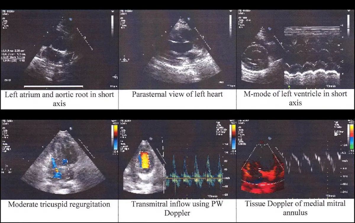 Hypertrophic Cardiomyopathy (HCM) in Cats on Echocardiography: What It Means