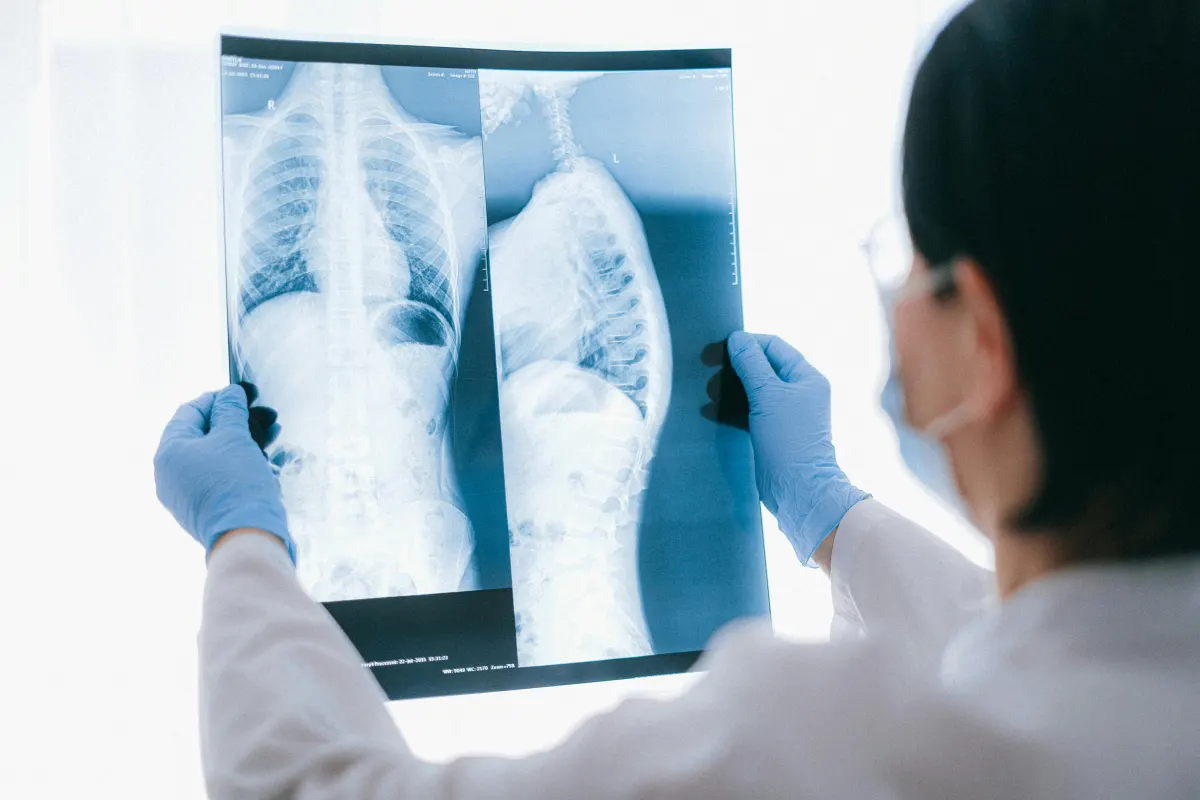 Found a Lung Nodule on Your CT Scan? Here's What to Do Next