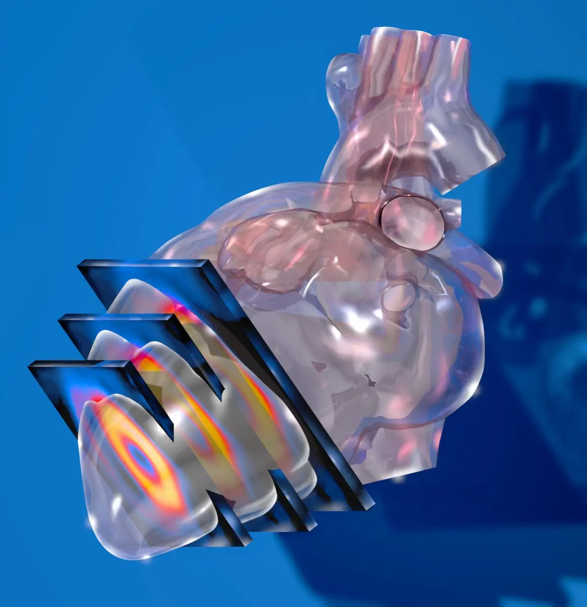 Myocardial Perfusion Scan: What Reversible and Fixed Defects Mean